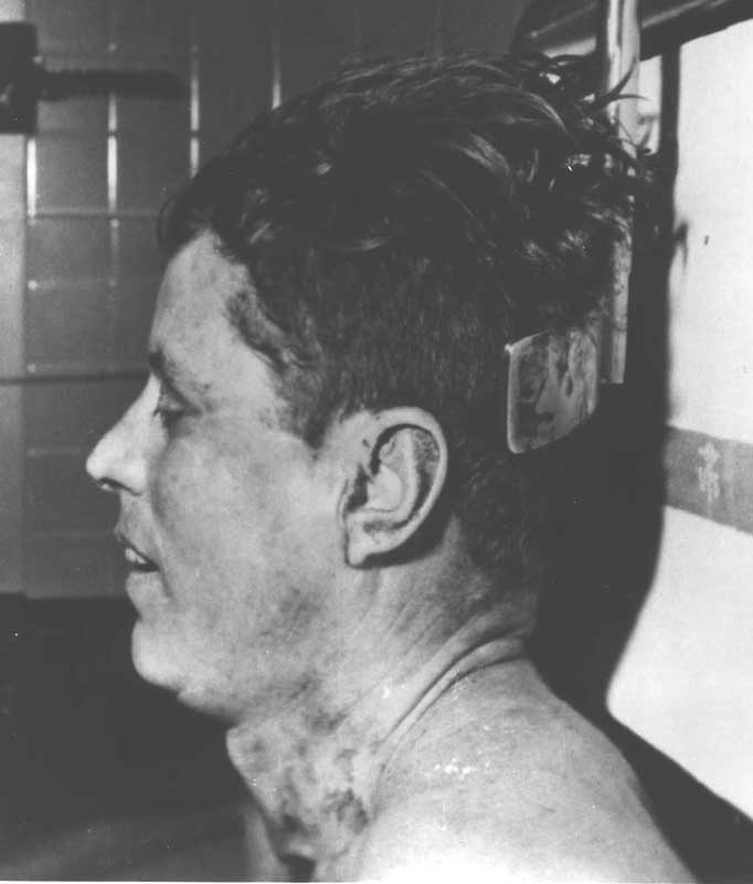 John F. Kennedy autopsy photo (#4)